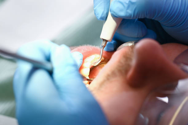 Urgent Tooth Repair in MN